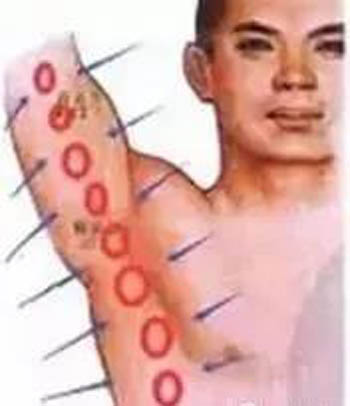 腋下极泉大筋