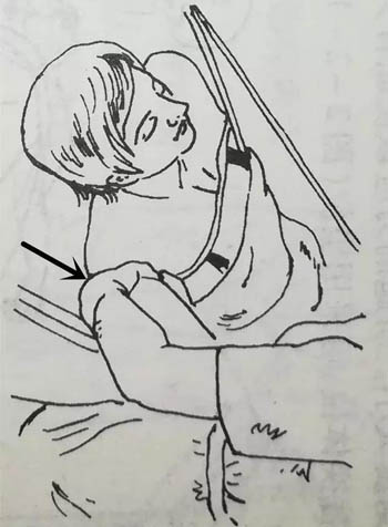 肩关节松动术
