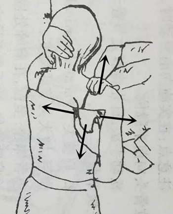 肩关节松动术