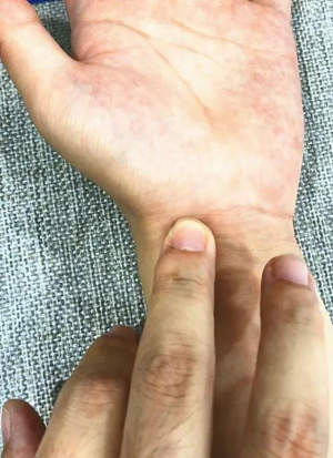 点按太渊做穴位导引
