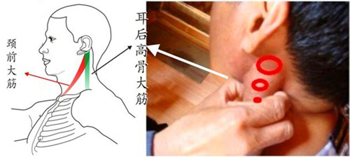 耳后高骨大筋