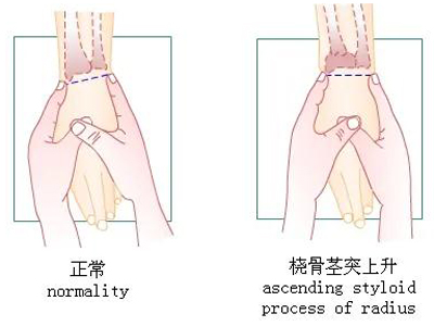 脊柱与四肢特殊检查法