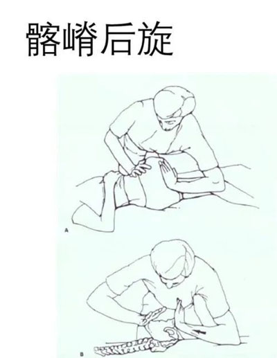 骨盆关节松动术操作要领！