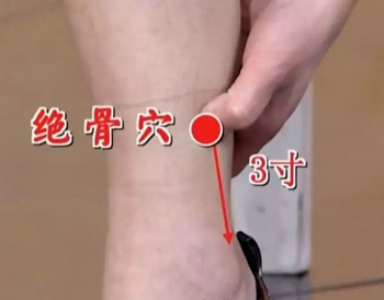 绝骨穴
