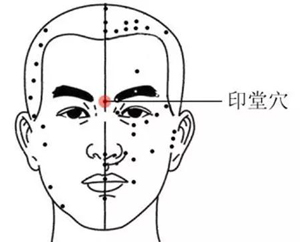印堂穴