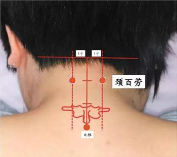 颈百劳