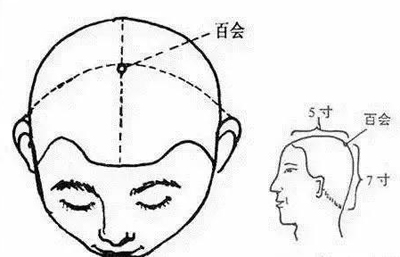 百会穴