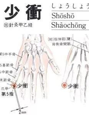 少冲穴