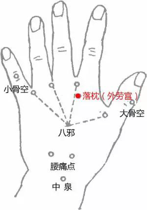 劳宫