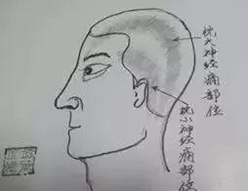 枕小神经