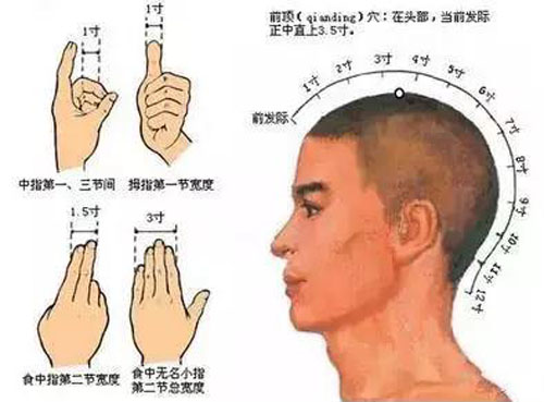 百会