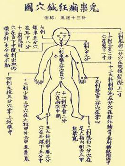 鬼门十三针