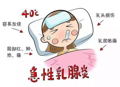急性乳腺炎