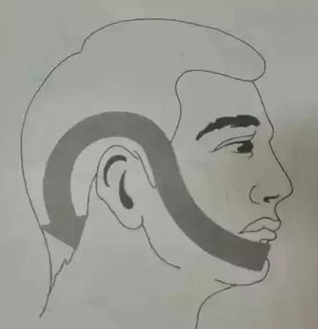 面部刮痧