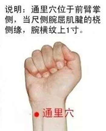 通里穴