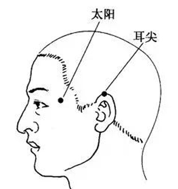 耳尖。太阳