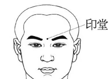 印堂