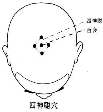 四神聪