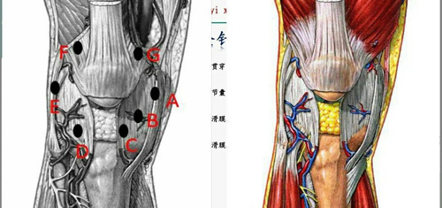 膝关节骨性关节炎的治疗