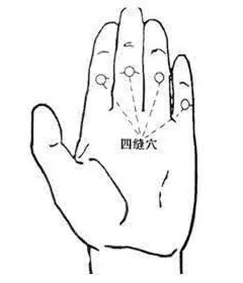 四缝穴