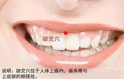 龈交穴