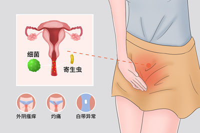 阴道炎反复发作该怎么办？