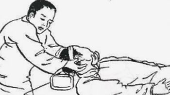 中医整脊治愈精神分裂症
