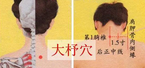 大杼穴：颈椎病、咳嗽、气喘