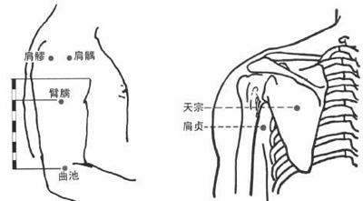 肩髃、肩贞、肩髎