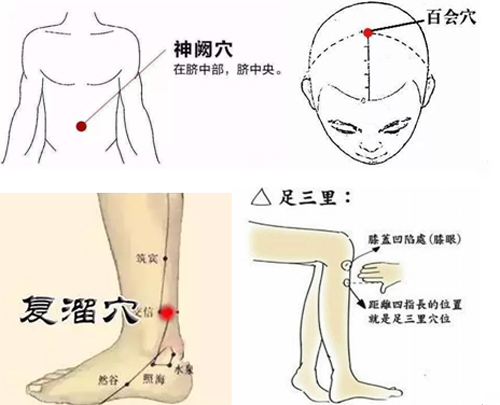 神厥，足三里，百会，复溜