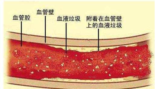 血稠