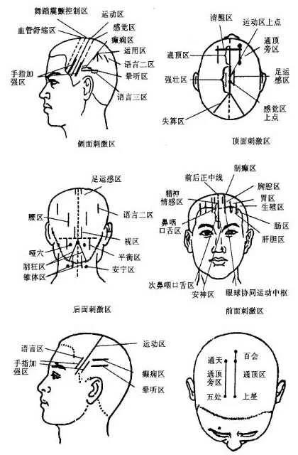 痹证穴位