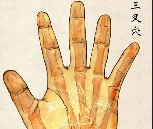 三叉一穴