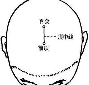 治疗“满头白发”的奇穴！前顶穴