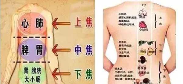 十字灸法