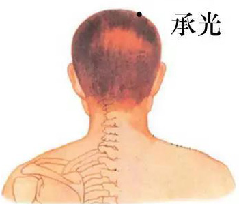 经常拍打承光穴可改善老花眼