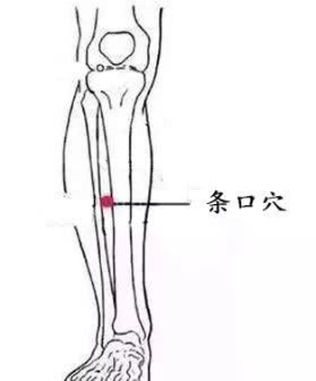 针灸：肩周炎可针刺条口穴