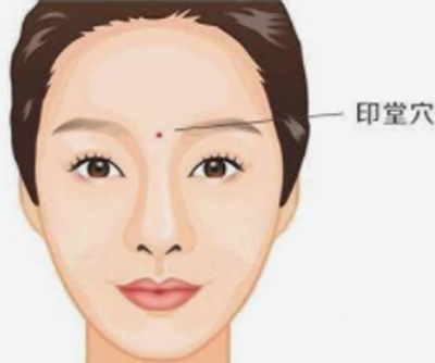针刺印堂穴可治疗这4种疾病