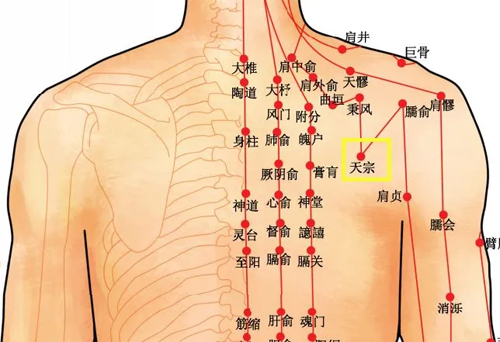 一奇穴治疗乳腺增生