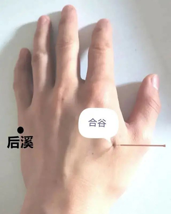 针灸治疗中风之后手功能障碍