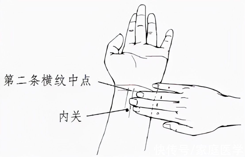 针刺内关穴治急性乳腺炎