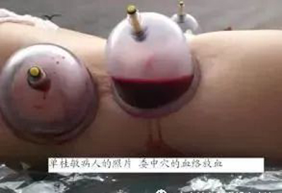 委中一穴能调多种病症