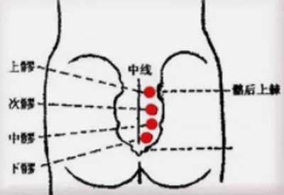 中髎穴：便秘、月经不调、腰痛
