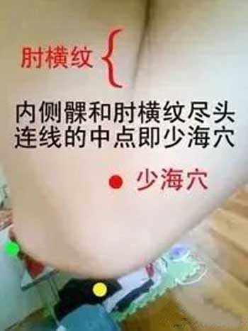 手麻，腹股沟痛验案