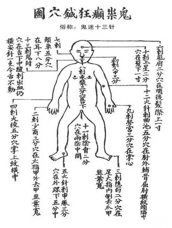 天医派鬼门十三针（内有针咒）