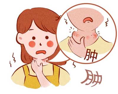 胡毓恒先生治疗体表炎性肿块验方