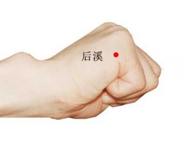 急性腰扭伤一针疗法