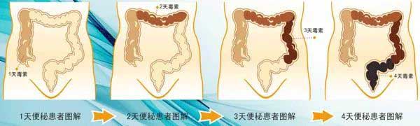 麻仁丸，治老人习惯性便秘