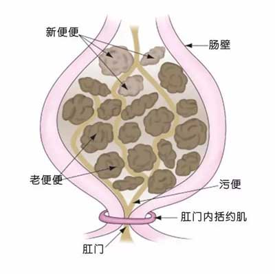 麻仁丸，治老人习惯性便秘