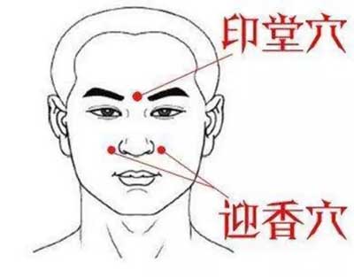 怎样用艾灸治鼻炎？